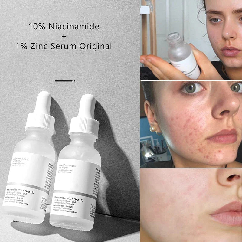 Ordinary Niacinamide Serum 10% + Zinc 1%